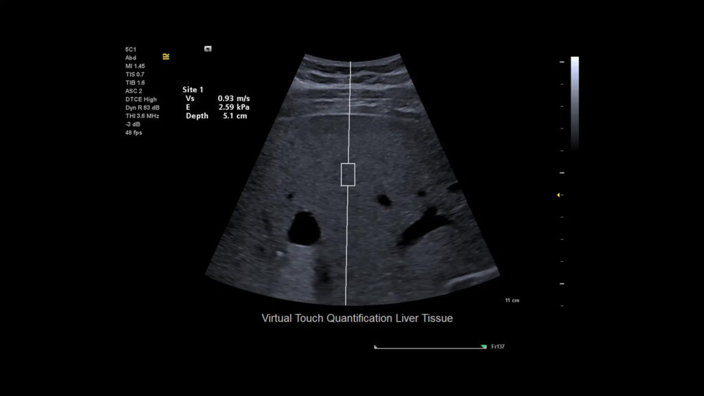 Ecograf ACUSON Juniper Siemens Healthineers {"type":"elementor","siteurl":"https://supermedical.cwtest.ro/wp-json/","elements":[{"id":"6d33bef","elType":"widget","isInner":false,"isLocked":false,"settings":{"image":{"id":20095,"url":"https://supermedical.cwtest.ro/wp-content/uploads/2023/01/ENCORE-Latex-Ortho_3D-Glove_Mallet_PIM.jpg","alt":"","source":"library","size":""},"space":{"unit":"%","size":""},"space_mobile":{"unit":"%","size":100},"opacity_hover":{"unit":"px","size":1},"css_filters_hover_blur":{"unit":"px","size":1.1},"css_filters_hover_brightness":{"unit":"px","size":123},"background_hover_transition":{"unit":"px","size":0.6},"hover_animation":"hang","_margin":{"unit":"px","top":"0","right":"0","bottom":"0","left":"0","isLinked":false},"_background_position":"center center","_background_attachment":"fixed","_background_repeat":"no-repeat","_background_size":"contain","css_filters_brightness":{"unit":"px","size":101},"css_filters_contrast":{"unit":"px","size":98},"css_filters_saturate":{"unit":"px","size":0},"css_filters_hue":{"unit":"px","size":48},"image_size":"large","image_custom_dimension":{"width":"","height":""},"align":"","align_tablet":"","align_mobile":"","caption_source":"none","caption":"","link_to":"none","link":{"url":"","is_external":"","nofollow":"","custom_attributes":""},"open_lightbox":"default","view":"traditional","width":{"unit":"%","size":"","sizes":[]},"width_tablet":{"unit":"%","size":"","sizes":[]},"width_mobile":{"unit":"%","size":"","sizes":[]},"space_tablet":{"unit":"%","size":"","sizes":[]},"height":{"unit":"px","size":"","sizes":[]},"height_tablet":{"unit":"px","size":"","sizes":[]},"height_mobile":{"unit":"px","size":"","sizes":[]},"object-fit":"","object-fit_tablet":"","object-fit_mobile":"","object-position":"center center","object-position_tablet":"","object-position_mobile":"","opacity":{"unit":"px","size":"","sizes":[]},"css_filters_css_filter":"","css_filters_blur":{"unit":"px","size":0,"sizes":[]},"css_filters_hover_css_filter":"","css_filters_hover_contrast":{"unit":"px","size":100,"sizes":[]},"css_filters_hover_saturate":{"unit":"px","size":100,"sizes":[]},"css_filters_hover_hue":{"unit":"px","size":0,"sizes":[]},"image_border_border":"","image_border_width":{"unit":"px","top":"","right":"","bottom":"","left":"","isLinked":true},"image_border_width_tablet":{"unit":"px","top":"","right":"","bottom":"","left":"","isLinked":true},"image_border_width_mobile":{"unit":"px","top":"","right":"","bottom":"","left":"","isLinked":true},"image_border_color":"","image_border_radius":{"unit":"px","top":"","right":"","bottom":"","left":"","isLinked":true},"image_border_radius_tablet":{"unit":"px","top":"","right":"","bottom":"","left":"","isLinked":true},"image_border_radius_mobile":{"unit":"px","top":"","right":"","bottom":"","left":"","isLinked":true},"image_box_shadow_box_shadow_type":"","image_box_shadow_box_shadow":{"horizontal":0,"vertical":0,"blur":10,"spread":0,"color":"rgba(0,0,0,0.5)"},"caption_align":"","caption_align_tablet":"","caption_align_mobile":"","text_color":"","caption_background_color":"","caption_typography_typography":"","caption_typography_font_family":"","caption_typography_font_size":{"unit":"px","size":"","sizes":[]},"caption_typography_font_size_tablet":{"unit":"px","size":"","sizes":[]},"caption_typography_font_size_mobile":{"unit":"px","size":"","sizes":[]},"caption_typography_font_weight":"","caption_typography_text_transform":"","caption_typography_font_style":"","caption_typography_text_decoration":"","caption_typography_line_height":{"unit":"px","size":"","sizes":[]},"caption_typography_line_height_tablet":{"unit":"em","size":"","sizes":[]},"caption_typography_line_height_mobile":{"unit":"em","size":"","sizes":[]},"caption_typography_letter_spacing":{"unit":"px","size":"","sizes":[]},"caption_typography_letter_spacing_tablet":{"unit":"px","size":"","sizes":[]},"caption_typography_letter_spacing_mobile":{"unit":"px","size":"","sizes":[]},"caption_typography_word_spacing":{"unit":"px","size":"","sizes":[]},"caption_typography_word_spacing_tablet":{"unit":"em","size":"","sizes":[]},"caption_typography_word_spacing_mobile":{"unit":"em","size":"","sizes":[]},"caption_text_shadow_text_shadow_type":"","caption_text_shadow_text_shadow":{"horizontal":0,"vertical":0,"blur":10,"color":"rgba(0,0,0,0.3)"},"caption_space":{"unit":"px","size":"","sizes":[]},"caption_space_tablet":{"unit":"px","size":"","sizes":[]},"caption_space_mobile":{"unit":"px","size":"","sizes":[]},"_title":"","_margin_tablet":{"unit":"px","top":"","right":"","bottom":"","left":"","isLinked":true},"_margin_mobile":{"unit":"px","top":"","right":"","bottom":"","left":"","isLinked":true},"_padding":{"unit":"px","top":"","right":"","bottom":"","left":"","isLinked":true},"_padding_tablet":{"unit":"px","top":"","right":"","bottom":"","left":"","isLinked":true},"_padding_mobile":{"unit":"px","top":"","right":"","bottom":"","left":"","isLinked":true},"_element_width":"","_element_width_tablet":"","_element_width_mobile":"","_element_custom_width":{"unit":"%","size":"","sizes":[]},"_element_custom_width_tablet":{"unit":"px","size":"","sizes":[]},"_element_custom_width_mobile":{"unit":"px","size":"","sizes":[]},"_element_vertical_align":"","_element_vertical_align_tablet":"","_element_vertical_align_mobile":"","_position":"","_offset_orientation_h":"start","_offset_x":{"unit":"px","size":"0","sizes":[]},"_offset_x_tablet":{"unit":"px","size":"","sizes":[]},"_offset_x_mobile":{"unit":"px","size":"","sizes":[]},"_offset_x_end":{"unit":"px","size":"0","sizes":[]},"_offset_x_end_tablet":{"unit":"px","size":"","sizes":[]},"_offset_x_end_mobile":{"unit":"px","size":"","sizes":[]},"_offset_orientation_v":"start","_offset_y":{"unit":"px","size":"0","sizes":[]},"_offset_y_tablet":{"unit":"px","size":"","sizes":[]},"_offset_y_mobile":{"unit":"px","size":"","sizes":[]},"_offset_y_end":{"unit":"px","size":"0","sizes":[]},"_offset_y_end_tablet":{"unit":"px","size":"","sizes":[]},"_offset_y_end_mobile":{"unit":"px","size":"","sizes":[]},"_z_index":"","_z_index_tablet":"","_z_index_mobile":"","_element_id":"","_css_classes":"","exad_enable_section_sticky":"no","exad_sticky_top_spacing":20,"exad_container_link":{"url":"","is_external":"","nofollow":"","custom_attributes":""},"exad_container_link_opacity":{"unit":"px","size":"","sizes":[]},"exad_container_link_opacity_hover":{"unit":"px","size":"","sizes":[]},"motion_fx_motion_fx_scrolling":"","motion_fx_translateY_effect":"","motion_fx_translateY_direction":"","motion_fx_translateY_speed":{"unit":"px","size":4,"sizes":[]},"motion_fx_translateY_affectedRange":{"unit":"%","size":"","sizes":{"start":0,"end":100}},"motion_fx_translateX_effect":"","motion_fx_translateX_direction":"","motion_fx_translateX_speed":{"unit":"px","size":4,"sizes":[]},"motion_fx_translateX_affectedRange":{"unit":"%","size":"","sizes":{"start":0,"end":100}},"motion_fx_opacity_effect":"","motion_fx_opacity_direction":"out-in","motion_fx_opacity_level":{"unit":"px","size":10,"sizes":[]},"motion_fx_opacity_range":{"unit":"%","size":"","sizes":{"start":20,"end":80}},"motion_fx_blur_effect":"","motion_fx_blur_direction":"out-in","motion_fx_blur_level":{"unit":"px","size":7,"sizes":[]},"motion_fx_blur_range":{"unit":"%","size":"","sizes":{"start":20,"end":80}},"motion_fx_rotateZ_effect":"","motion_fx_rotateZ_direction":"","motion_fx_rotateZ_speed":{"unit":"px","size":1,"sizes":[]},"motion_fx_rotateZ_affectedRange":{"unit":"%","size":"","sizes":{"start":0,"end":100}},"motion_fx_scale_effect":"","motion_fx_scale_direction":"out-in","motion_fx_scale_speed":{"unit":"px","size":4,"sizes":[]},"motion_fx_scale_range":{"unit":"%","size":"","sizes":{"start":20,"end":80}},"motion_fx_transform_origin_x":"center","motion_fx_transform_origin_y":"center","motion_fx_devices":["desktop","tablet","mobile"],"motion_fx_range":"","motion_fx_motion_fx_mouse":"","motion_fx_mouseTrack_effect":"","motion_fx_mouseTrack_direction":"","motion_fx_mouseTrack_speed":{"unit":"px","size":1,"sizes":[]},"motion_fx_tilt_effect":"","motion_fx_tilt_direction":"","motion_fx_tilt_speed":{"unit":"px","size":4,"sizes":[]},"sticky":"","sticky_on":["desktop","tablet","mobile"],"sticky_offset":0,"sticky_offset_tablet":"","sticky_offset_mobile":"","sticky_effects_offset":0,"sticky_effects_offset_tablet":"","sticky_effects_offset_mobile":"","sticky_parent":"","_animation":"","_animation_tablet":"","_animation_mobile":"","animation_duration":"","_animation_delay":"","_transform_rotate_popover":"","_transform_rotateZ_effect":{"unit":"px","size":"","sizes":[]},"_transform_rotateZ_effect_tablet":{"unit":"deg","size":"","sizes":[]},"_transform_rotateZ_effect_mobile":{"unit":"deg","size":"","sizes":[]},"_transform_rotate_3d":"","_transform_rotateX_effect":{"unit":"px","size":"","sizes":[]},"_transform_rotateX_effect_tablet":{"unit":"deg","size":"","sizes":[]},"_transform_rotateX_effect_mobile":{"unit":"deg","size":"","sizes":[]},"_transform_rotateY_effect":{"unit":"px","size":"","sizes":[]},"_transform_rotateY_effect_tablet":{"unit":"deg","size":"","sizes":[]},"_transform_rotateY_effect_mobile":{"unit":"deg","size":"","sizes":[]},"_transform_perspective_effect":{"unit":"px","size":"","sizes":[]},"_transform_perspective_effect_tablet":{"unit":"px","size":"","sizes":[]},"_transform_perspective_effect_mobile":{"unit":"px","size":"","sizes":[]},"_transform_translate_popover":"","_transform_translateX_effect":{"unit":"px","size":"","sizes":[]},"_transform_translateX_effect_tablet":{"unit":"px","size":"","sizes":[]},"_transform_translateX_effect_mobile":{"unit":"px","size":"","sizes":[]},"_transform_translateY_effect":{"unit":"px","size":"","sizes":[]},"_transform_translateY_effect_tablet":{"unit":"px","size":"","sizes":[]},"_transform_translateY_effect_mobile":{"unit":"px","size":"","sizes":[]},"_transform_scale_popover":"","_transform_keep_proportions":"yes","_transform_scale_effect":{"unit":"px","size":"","sizes":[]},"_transform_scale_effect_tablet":{"unit":"px","size":"","sizes":[]},"_transform_scale_effect_mobile":{"unit":"px","size":"","sizes":[]},"_transform_scaleX_effect":{"unit":"px","size":"","sizes":[]},"_transform_scaleX_effect_tablet":{"unit":"px","size":"","sizes":[]},"_transform_scaleX_effect_mobile":{"unit":"px","size":"","sizes":[]},"_transform_scaleY_effect":{"unit":"px","size":"","sizes":[]},"_transform_scaleY_effect_tablet":{"unit":"px","size":"","sizes":[]},"_transform_scaleY_effect_mobile":{"unit":"px","size":"","sizes":[]},"_transform_skew_popover":"","_transform_skewX_effect":{"unit":"px","size":"","sizes":[]},"_transform_skewX_effect_tablet":{"unit":"deg","size":"","sizes":[]},"_transform_skewX_effect_mobile":{"unit":"deg","size":"","sizes":[]},"_transform_skewY_effect":{"unit":"px","size":"","sizes":[]},"_transform_skewY_effect_tablet":{"unit":"deg","size":"","sizes":[]},"_transform_skewY_effect_mobile":{"unit":"deg","size":"","sizes":[]},"_transform_flipX_effect":"","_transform_flipY_effect":"","_transform_rotate_popover_hover":"","_transform_rotateZ_effect_hover":{"unit":"px","size":"","sizes":[]},"_transform_rotateZ_effect_hover_tablet":{"unit":"deg","size":"","sizes":[]},"_transform_rotateZ_effect_hover_mobile":{"unit":"deg","size":"","sizes":[]},"_transform_rotate_3d_hover":"","_transform_rotateX_effect_hover":{"unit":"px","size":"","sizes":[]},"_transform_rotateX_effect_hover_tablet":{"unit":"deg","size":"","sizes":[]},"_transform_rotateX_effect_hover_mobile":{"unit":"deg","size":"","sizes":[]},"_transform_rotateY_effect_hover":{"unit":"px","size":"","sizes":[]},"_transform_rotateY_effect_hover_tablet":{"unit":"deg","size":"","sizes":[]},"_transform_rotateY_effect_hover_mobile":{"unit":"deg","size":"","sizes":[]},"_transform_perspective_effect_hover":{"unit":"px","size":"","sizes":[]},"_transform_perspective_effect_hover_tablet":{"unit":"px","size":"","sizes":[]},"_transform_perspective_effect_hover_mobile":{"unit":"px","size":"","sizes":[]},"_transform_translate_popover_hover":"","_transform_translateX_effect_hover":{"unit":"px","size":"","sizes":[]},"_transform_translateX_effect_hover_tablet":{"unit":"px","size":"","sizes":[]},"_transform_translateX_effect_hover_mobile":{"unit":"px","size":"","sizes":[]},"_transform_translateY_effect_hover":{"unit":"px","size":"","sizes":[]},"_transform_translateY_effect_hover_tablet":{"unit":"px","size":"","sizes":[]},"_transform_translateY_effect_hover_mobile":{"unit":"px","size":"","sizes":[]},"_transform_scale_popover_hover":"","_transform_keep_proportions_hover":"yes","_transform_scale_effect_hover":{"unit":"px","size":"","sizes":[]},"_transform_scale_effect_hover_tablet":{"unit":"px","size":"","sizes":[]},"_transform_scale_effect_hover_mobile":{"unit":"px","size":"","sizes":[]},"_transform_scaleX_effect_hover":{"unit":"px","size":"","sizes":[]},"_transform_scaleX_effect_hover_tablet":{"unit":"px","size":"","sizes":[]},"_transform_scaleX_effect_hover_mobile":{"unit":"px","size":"","sizes":[]},"_transform_scaleY_effect_hover":{"unit":"px","size":"","sizes":[]},"_transform_scaleY_effect_hover_tablet":{"unit":"px","size":"","sizes":[]},"_transform_scaleY_effect_hover_mobile":{"unit":"px","size":"","sizes":[]},"_transform_skew_popover_hover":"","_transform_skewX_effect_hover":{"unit":"px","size":"","sizes":[]},"_transform_skewX_effect_hover_tablet":{"unit":"deg","size":"","sizes":[]},"_transform_skewX_effect_hover_mobile":{"unit":"deg","size":"","sizes":[]},"_transform_skewY_effect_hover":{"unit":"px","size":"","sizes":[]},"_transform_skewY_effect_hover_tablet":{"unit":"deg","size":"","sizes":[]},"_transform_skewY_effect_hover_mobile":{"unit":"deg","size":"","sizes":[]},"_transform_flipX_effect_hover":"","_transform_flipY_effect_hover":"","_transform_transition_hover":{"unit":"px","size":"","sizes":[]},"motion_fx_transform_x_anchor_point":"","motion_fx_transform_x_anchor_point_tablet":"","motion_fx_transform_x_anchor_point_mobile":"","motion_fx_transform_y_anchor_point":"","motion_fx_transform_y_anchor_point_tablet":"","motion_fx_transform_y_anchor_point_mobile":"","_background_background":"","_background_color":"","_background_color_stop":{"unit":"%","size":0,"sizes":[]},"_background_color_b":"#f2295b","_background_color_b_stop":{"unit":"%","size":100,"sizes":[]},"_background_gradient_type":"linear","_background_gradient_angle":{"unit":"deg","size":180,"sizes":[]},"_background_gradient_position":"center center","_background_image":{"url":"","id":"","size":""},"_background_image_tablet":{"url":"","id":"","size":""},"_background_image_mobile":{"url":"","id":"","size":""},"_background_position_tablet":"","_background_position_mobile":"","_background_xpos":{"unit":"px","size":0,"sizes":[]},"_background_xpos_tablet":{"unit":"px","size":0,"sizes":[]},"_background_xpos_mobile":{"unit":"px","size":0,"sizes":[]},"_background_ypos":{"unit":"px","size":0,"sizes":[]},"_background_ypos_tablet":{"unit":"px","size":0,"sizes":[]},"_background_ypos_mobile":{"unit":"px","size":0,"sizes":[]},"_background_repeat_tablet":"","_background_repeat_mobile":"","_background_size_tablet":"","_background_size_mobile":"","_background_bg_width":{"unit":"%","size":100,"sizes":[]},"_background_bg_width_tablet":{"unit":"px","size":"","sizes":[]},"_background_bg_width_mobile":{"unit":"px","size":"","sizes":[]},"_background_video_link":"","_background_video_start":"","_background_video_end":"","_background_play_once":"","_background_play_on_mobile":"","_background_privacy_mode":"","_background_video_fallback":{"url":"","id":"","size":""},"_background_slideshow_gallery":[],"_background_slideshow_loop":"yes","_background_slideshow_slide_duration":5000,"_background_slideshow_slide_transition":"fade","_background_slideshow_transition_duration":500,"_background_slideshow_background_size":"","_background_slideshow_background_size_tablet":"","_background_slideshow_background_size_mobile":"","_background_slideshow_background_position":"","_background_slideshow_background_position_tablet":"","_background_slideshow_background_position_mobile":"","_background_slideshow_lazyload":"","_background_slideshow_ken_burns":"","_background_slideshow_ken_burns_zoom_direction":"in","_background_hover_background":"","_background_hover_color":"","_background_hover_color_stop":{"unit":"%","size":0,"sizes":[]},"_background_hover_color_b":"#f2295b","_background_hover_color_b_stop":{"unit":"%","size":100,"sizes":[]},"_background_hover_gradient_type":"linear","_background_hover_gradient_angle":{"unit":"deg","size":180,"sizes":[]},"_background_hover_gradient_position":"center center","_background_hover_image":{"url":"","id":"","size":""},"_background_hover_image_tablet":{"url":"","id":"","size":""},"_background_hover_image_mobile":{"url":"","id":"","size":""},"_background_hover_position":"","_background_hover_position_tablet":"","_background_hover_position_mobile":"","_background_hover_xpos":{"unit":"px","size":0,"sizes":[]},"_background_hover_xpos_tablet":{"unit":"px","size":0,"sizes":[]},"_background_hover_xpos_mobile":{"unit":"px","size":0,"sizes":[]},"_background_hover_ypos":{"unit":"px","size":0,"sizes":[]},"_background_hover_ypos_tablet":{"unit":"px","size":0,"sizes":[]},"_background_hover_ypos_mobile":{"unit":"px","size":0,"sizes":[]},"_background_hover_attachment":"","_background_hover_repeat":"","_background_hover_repeat_tablet":"","_background_hover_repeat_mobile":"","_background_hover_size":"","_background_hover_size_tablet":"","_background_hover_size_mobile":"","_background_hover_bg_width":{"unit":"%","size":100,"sizes":[]},"_background_hover_bg_width_tablet":{"unit":"px","size":"","sizes":[]},"_background_hover_bg_width_mobile":{"unit":"px","size":"","sizes":[]},"_background_hover_video_link":"","_background_hover_video_start":"","_background_hover_video_end":"","_background_hover_play_once":"","_background_hover_play_on_mobile":"","_background_hover_privacy_mode":"","_background_hover_video_fallback":{"url":"","id":"","size":""},"_background_hover_slideshow_gallery":[],"_background_hover_slideshow_loop":"yes","_background_hover_slideshow_slide_duration":5000,"_background_hover_slideshow_slide_transition":"fade","_background_hover_slideshow_transition_duration":500,"_background_hover_slideshow_background_size":"","_background_hover_slideshow_background_size_tablet":"","_background_hover_slideshow_background_size_mobile":"","_background_hover_slideshow_background_position":"","_background_hover_slideshow_background_position_tablet":"","_background_hover_slideshow_background_position_mobile":"","_background_hover_slideshow_lazyload":"","_background_hover_slideshow_ken_burns":"","_background_hover_slideshow_ken_burns_zoom_direction":"in","_background_hover_transition":{"unit":"px","size":"","sizes":[]},"exad_enable_glass_effect":"no","exad_glass_effect_blur_value":20,"_border_border":"","_border_width":{"unit":"px","top":"","right":"","bottom":"","left":"","isLinked":true},"_border_width_tablet":{"unit":"px","top":"","right":"","bottom":"","left":"","isLinked":true},"_border_width_mobile":{"unit":"px","top":"","right":"","bottom":"","left":"","isLinked":true},"_border_color":"","_border_radius":{"unit":"px","top":"","right":"","bottom":"","left":"","isLinked":true},"_border_radius_tablet":{"unit":"px","top":"","right":"","bottom":"","left":"","isLinked":true},"_border_radius_mobile":{"unit":"px","top":"","right":"","bottom":"","left":"","isLinked":true},"_box_shadow_box_shadow_type":"","_box_shadow_box_shadow":{"horizontal":0,"vertical":0,"blur":10,"spread":0,"color":"rgba(0,0,0,0.5)"},"_box_shadow_box_shadow_position":" ","_border_hover_border":"","_border_hover_width":{"unit":"px","top":"","right":"","bottom":"","left":"","isLinked":true},"_border_hover_width_tablet":{"unit":"px","top":"","right":"","bottom":"","left":"","isLinked":true},"_border_hover_width_mobile":{"unit":"px","top":"","right":"","bottom":"","left":"","isLinked":true},"_border_hover_color":"","_border_radius_hover":{"unit":"px","top":"","right":"","bottom":"","left":"","isLinked":true},"_border_radius_hover_tablet":{"unit":"px","top":"","right":"","bottom":"","left":"","isLinked":true},"_border_radius_hover_mobile":{"unit":"px","top":"","right":"","bottom":"","left":"","isLinked":true},"_box_shadow_hover_box_shadow_type":"","_box_shadow_hover_box_shadow":{"horizontal":0,"vertical":0,"blur":10,"spread":0,"color":"rgba(0,0,0,0.5)"},"_box_shadow_hover_box_shadow_position":" ","_border_hover_transition":{"unit":"px","size":"","sizes":[]},"_mask_switch":"","_mask_shape":"circle","_mask_image":{"url":"","id":"","size":""},"_mask_notice":"","_mask_size":"contain","_mask_size_tablet":"","_mask_size_mobile":"","_mask_size_scale":{"unit":"%","size":100,"sizes":[]},"_mask_size_scale_tablet":{"unit":"px","size":"","sizes":[]},"_mask_size_scale_mobile":{"unit":"px","size":"","sizes":[]},"_mask_position":"center center","_mask_position_tablet":"","_mask_position_mobile":"","_mask_position_x":{"unit":"%","size":0,"sizes":[]},"_mask_position_x_tablet":{"unit":"px","size":"","sizes":[]},"_mask_position_x_mobile":{"unit":"px","size":"","sizes":[]},"_mask_position_y":{"unit":"%","size":0,"sizes":[]},"_mask_position_y_tablet":{"unit":"px","size":"","sizes":[]},"_mask_position_y_mobile":{"unit":"px","size":"","sizes":[]},"_mask_repeat":"no-repeat","_mask_repeat_tablet":"","_mask_repeat_mobile":"","hide_desktop":"","hide_tablet":"","hide_mobile":"","_attributes":"","custom_css":""},"defaultEditSettings":{"defaultEditRoute":"content"},"elements":[],"widgetType":"image","htmlCache":"\t\t\n\t\t\t\t\t\t\t\t\t\t\t\t\t\t\t\t\t\t\t\t\t\t\t\t\t\t\t\t\t\t\n\t\t","editSettings":{"defaultEditRoute":"content","panel":{"activeTab":"content","activeSection":"section_image"}}}]}