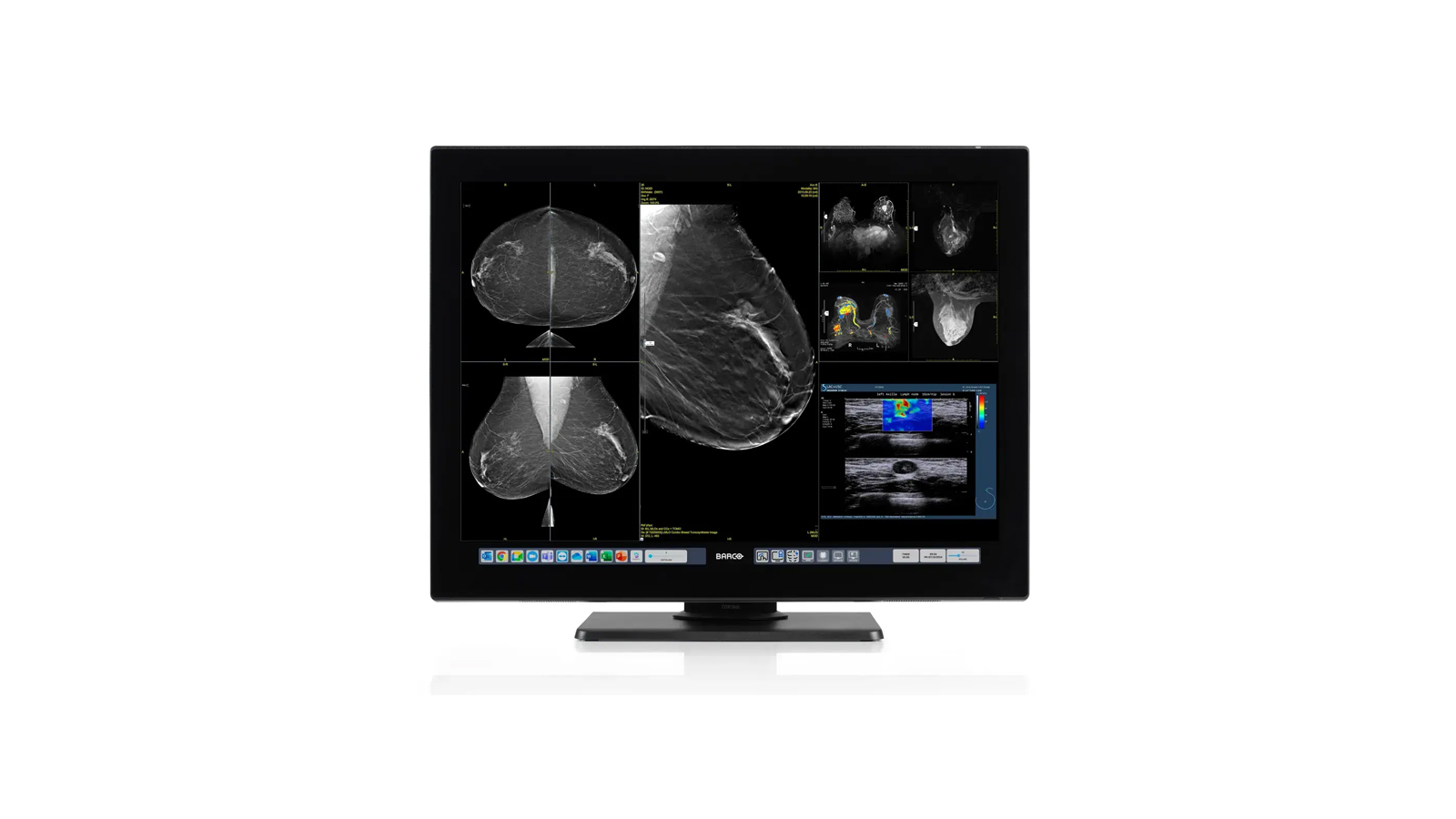 Monitor diagnostic radiologie 32MP Coronis OneLook Barco
