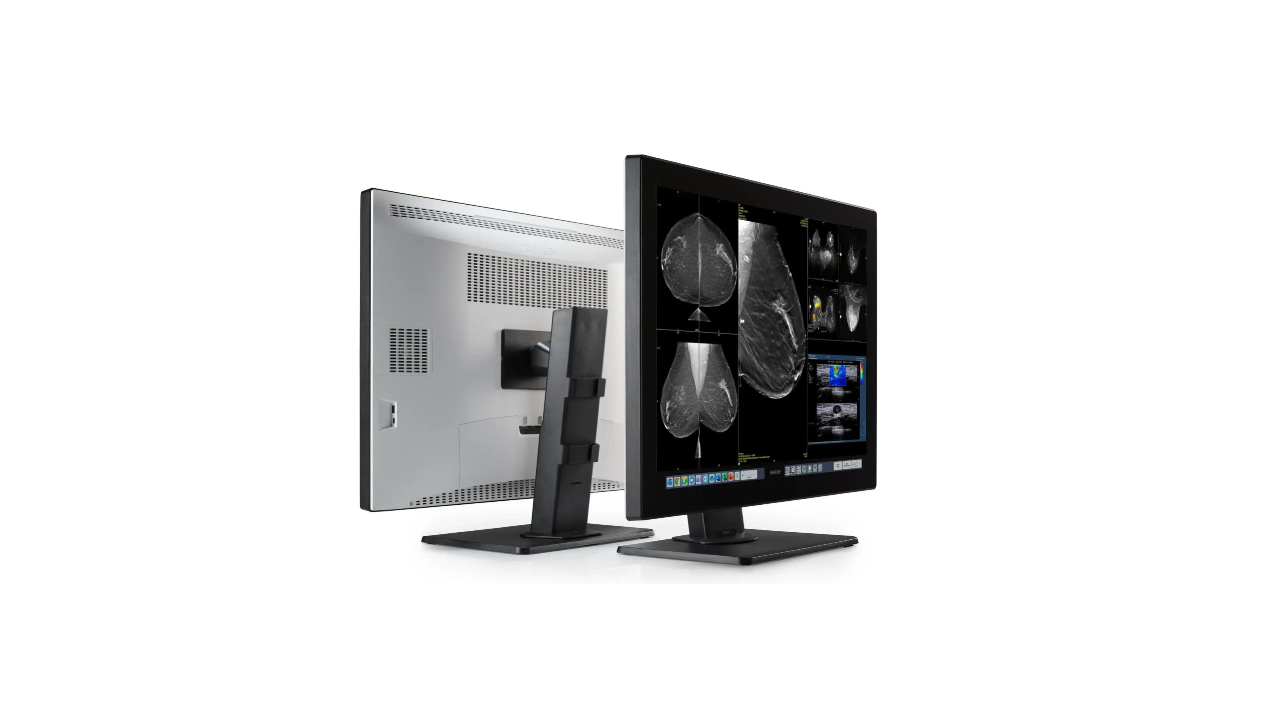Monitor diagnostic radiologie si mamografie 32MP Coronis OneLook Barco