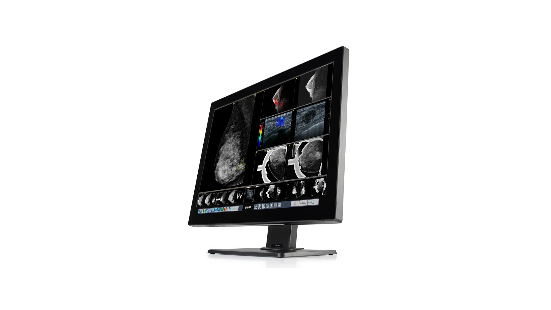 Monitor diagnostic radiologie si mamografie 32MP Coronis OneLook Barco