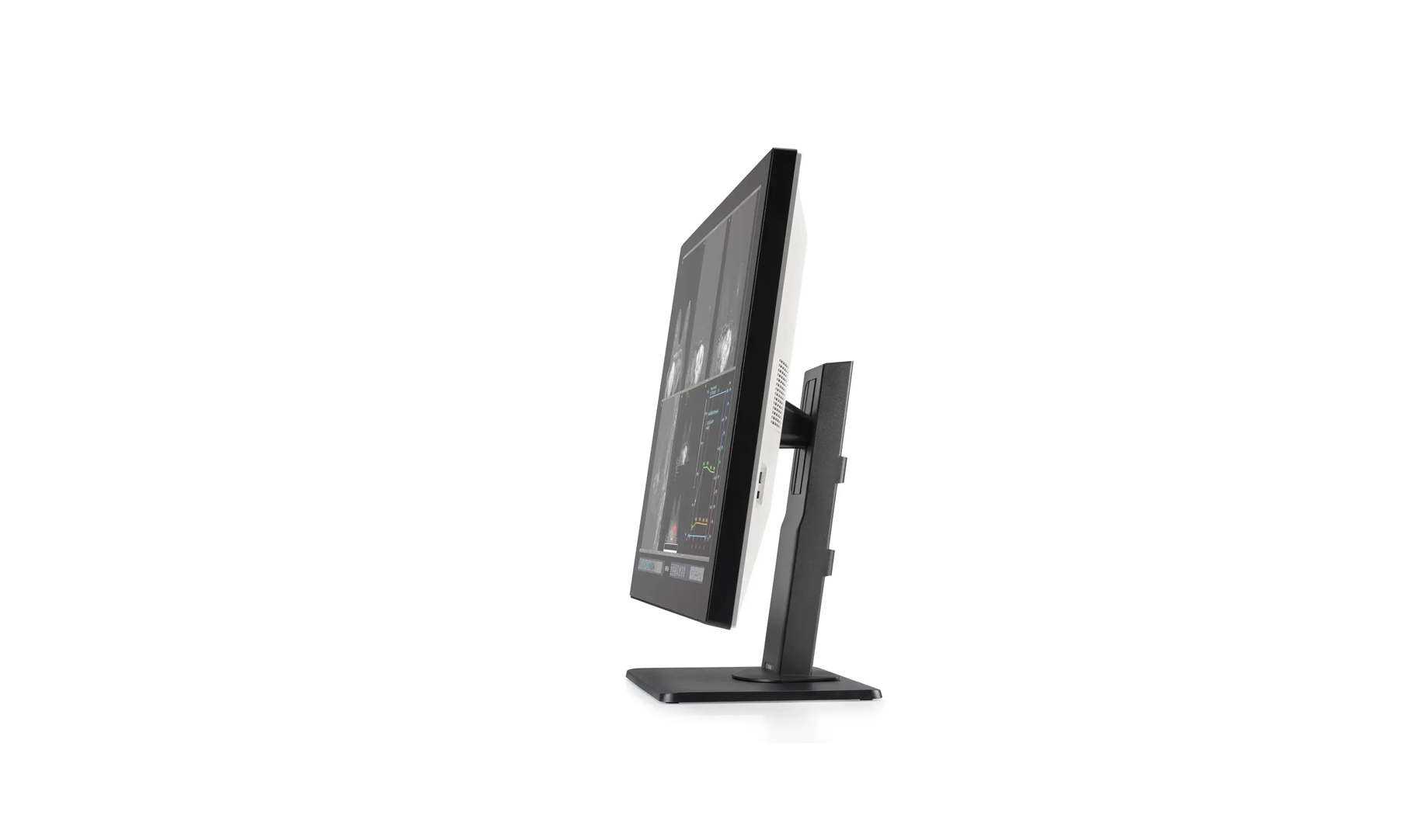 Monitor medical radiologie 32MP Coronis OneLook Barco.docx