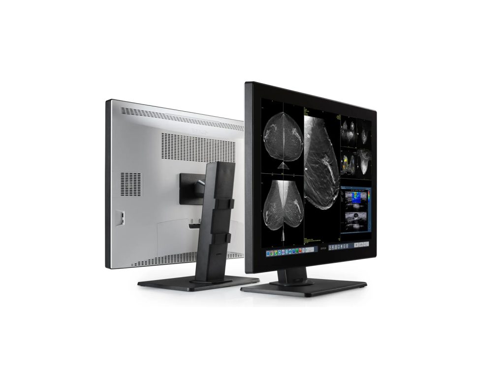 Monitor medical radiologie 32MP Coronis OneLook Barco.docx