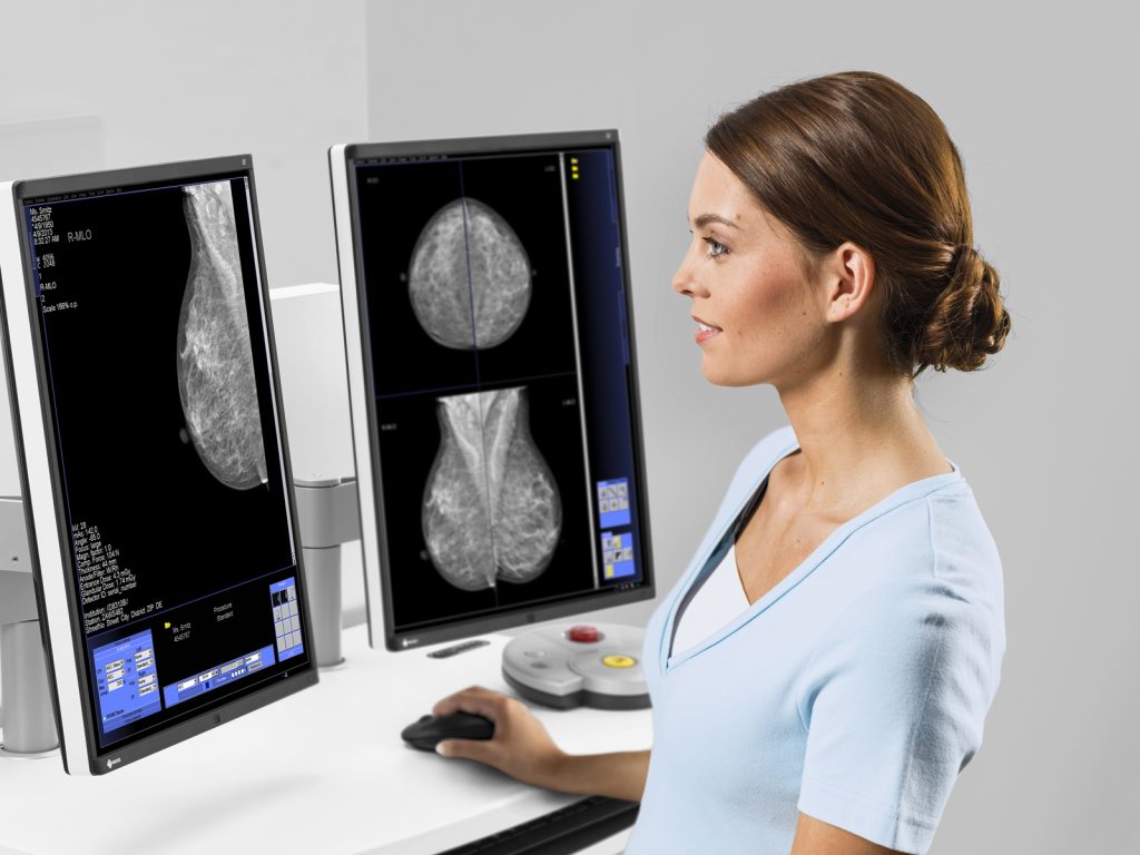 Mamograf digital MAMMOMAT Fusion