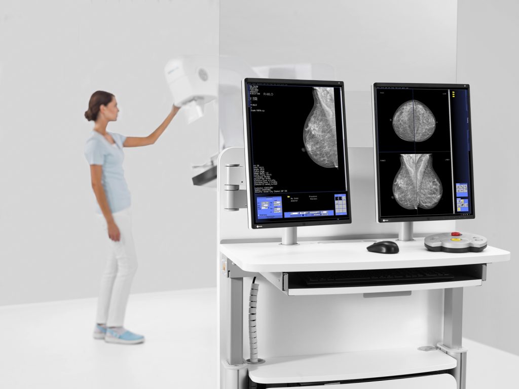 Mamograf digital MAMMOMAT Fusion