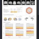 Aplicatie AI pentru neuroimagistica mdBrain photo review