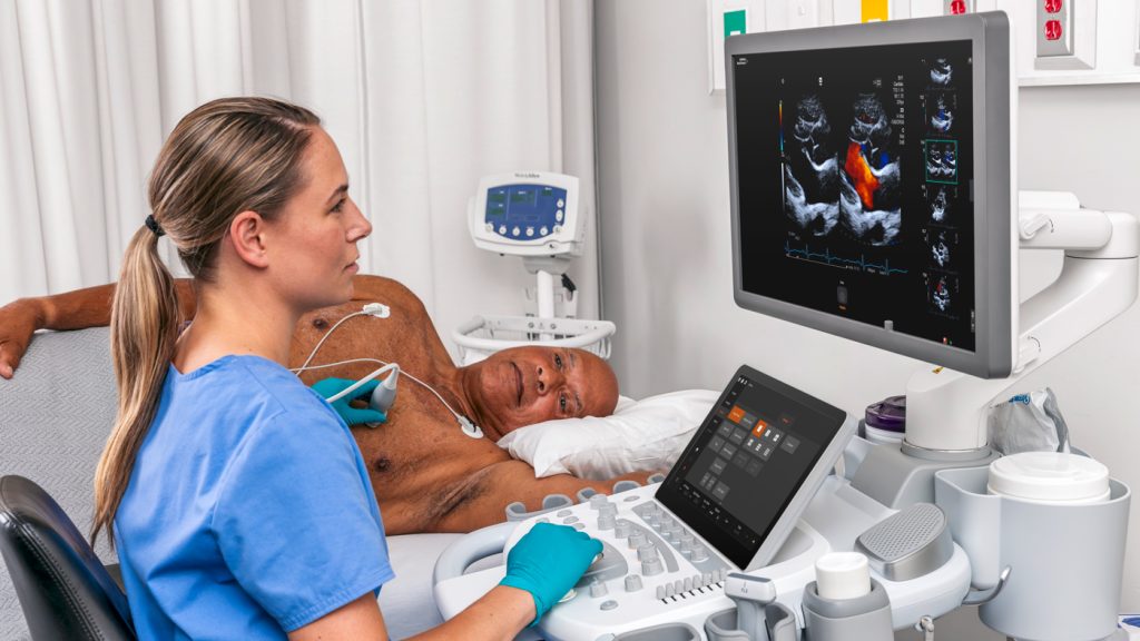Ecocradiograf ACUSON Origin Siemens Healthineers | Ecograf cardiovascular | Ecograf cardiologie cu măsurători automate realizate de inteligență artificială
