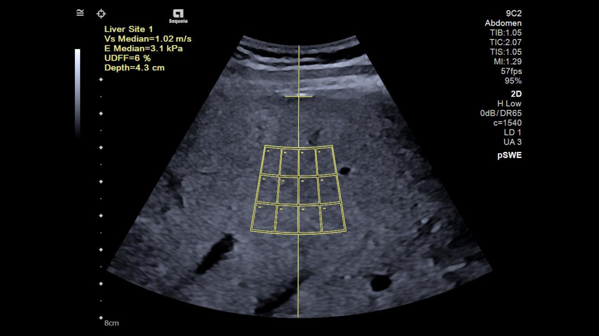 Ecograf hepatologie și gastroenterologie ACUSON Sequoia