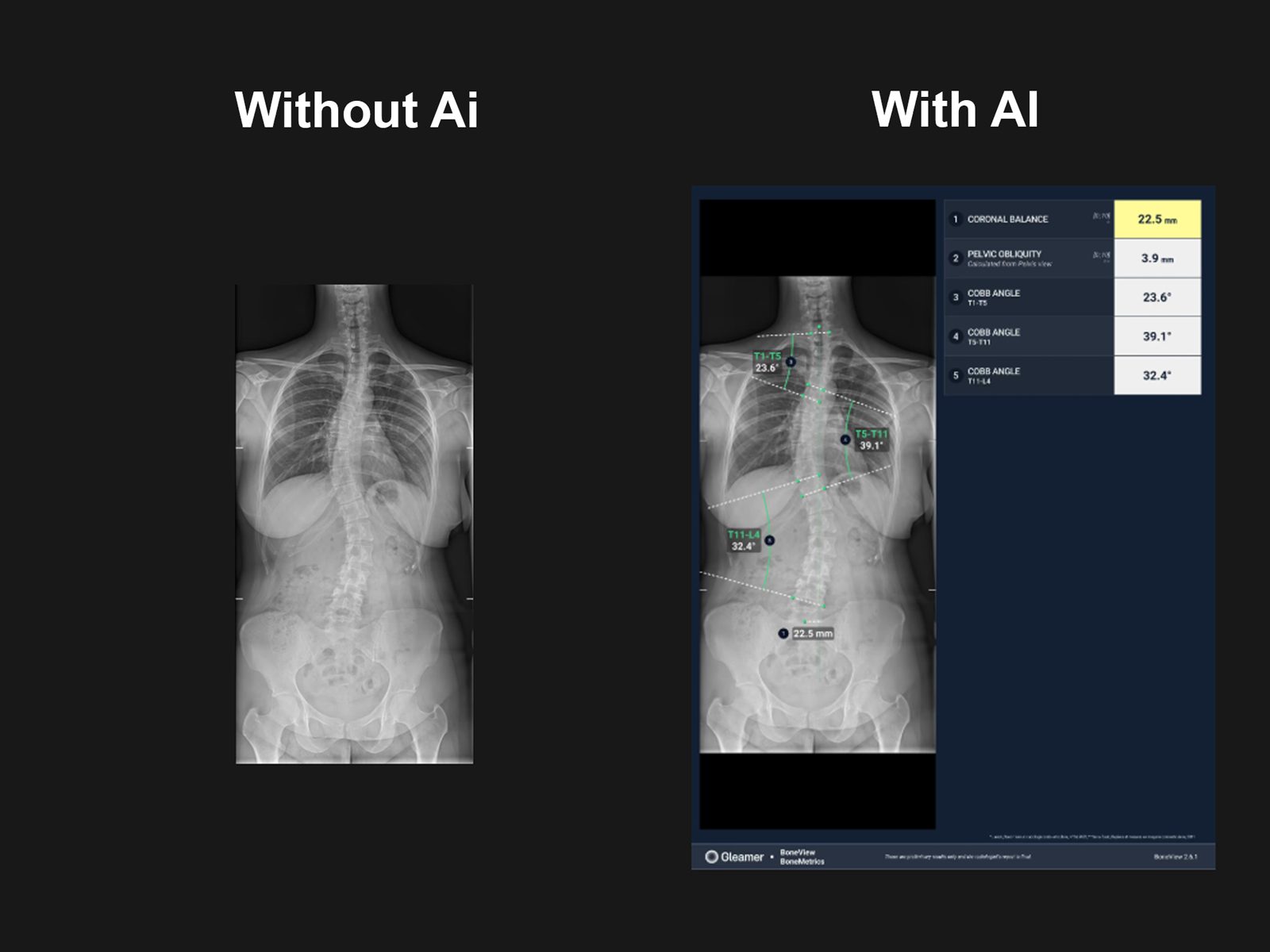 Aplicatie AI măsurătorilor musculo-scheletale (MSK)