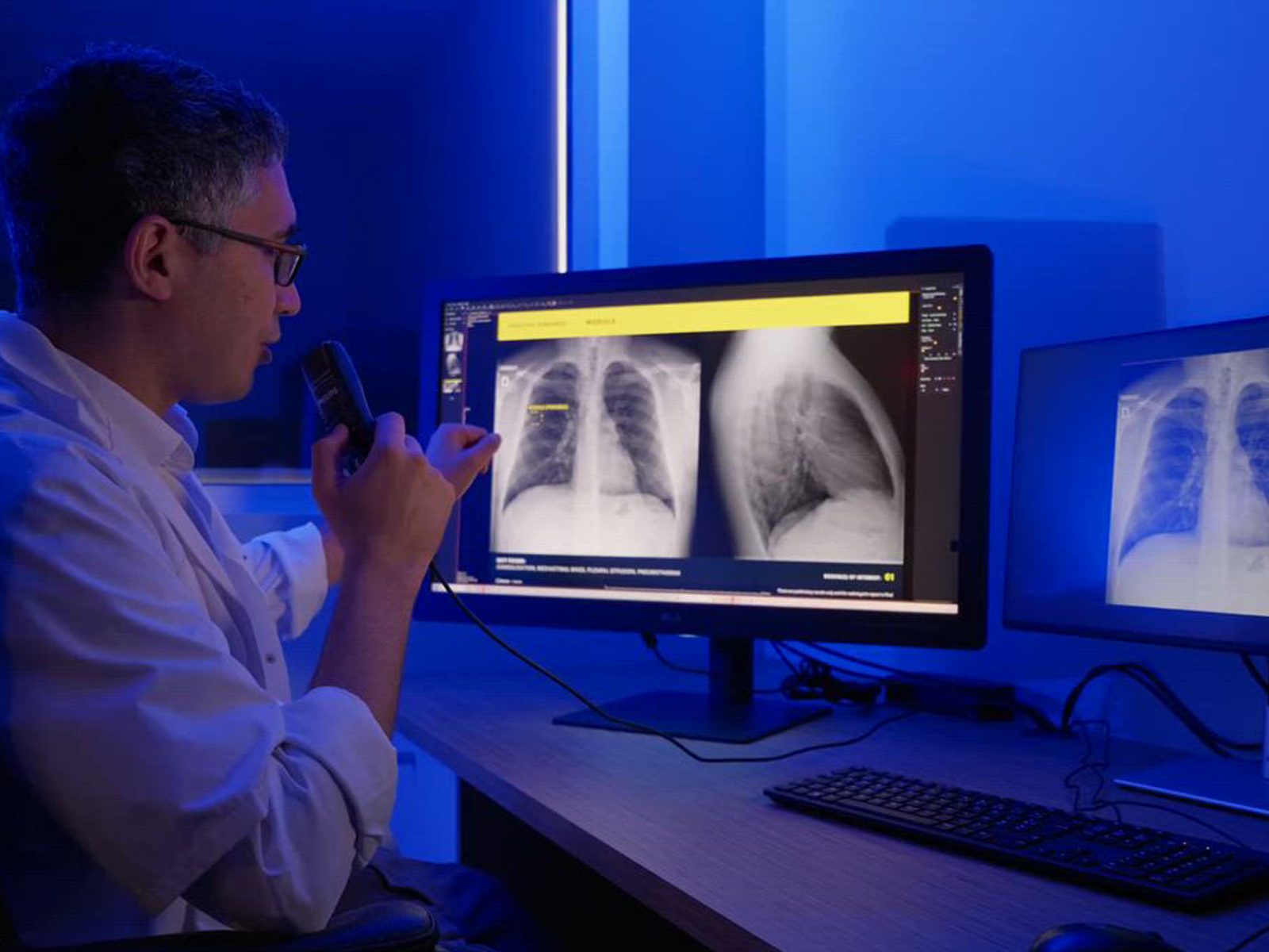 Aplicatie AI pentru detecția leziunilor toracice urgente Gleamer ChestView